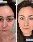 Contour Face