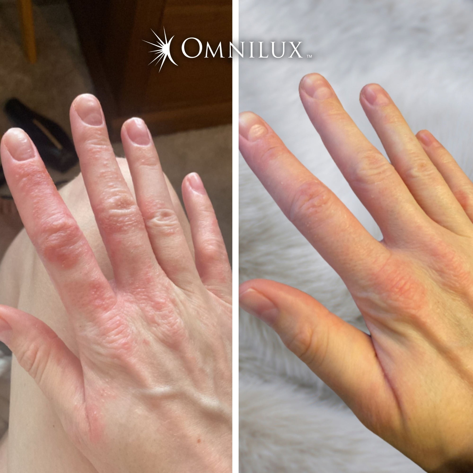 Contour Glove