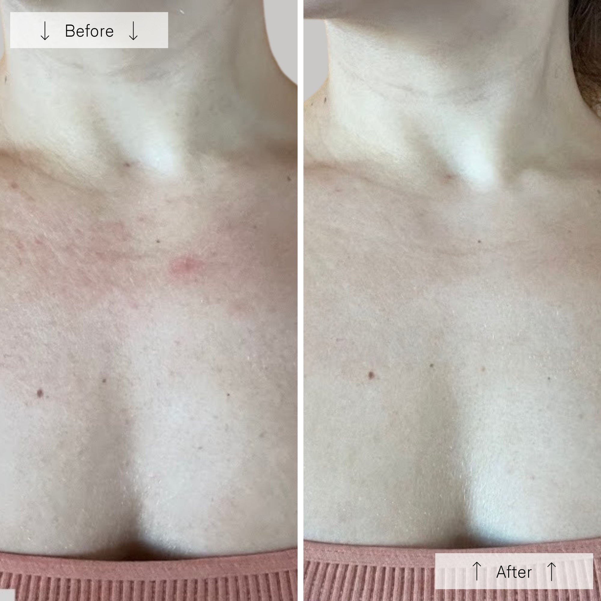 Contour Neck &amp; Décolleté