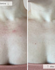 Contour Neck & Décolleté
