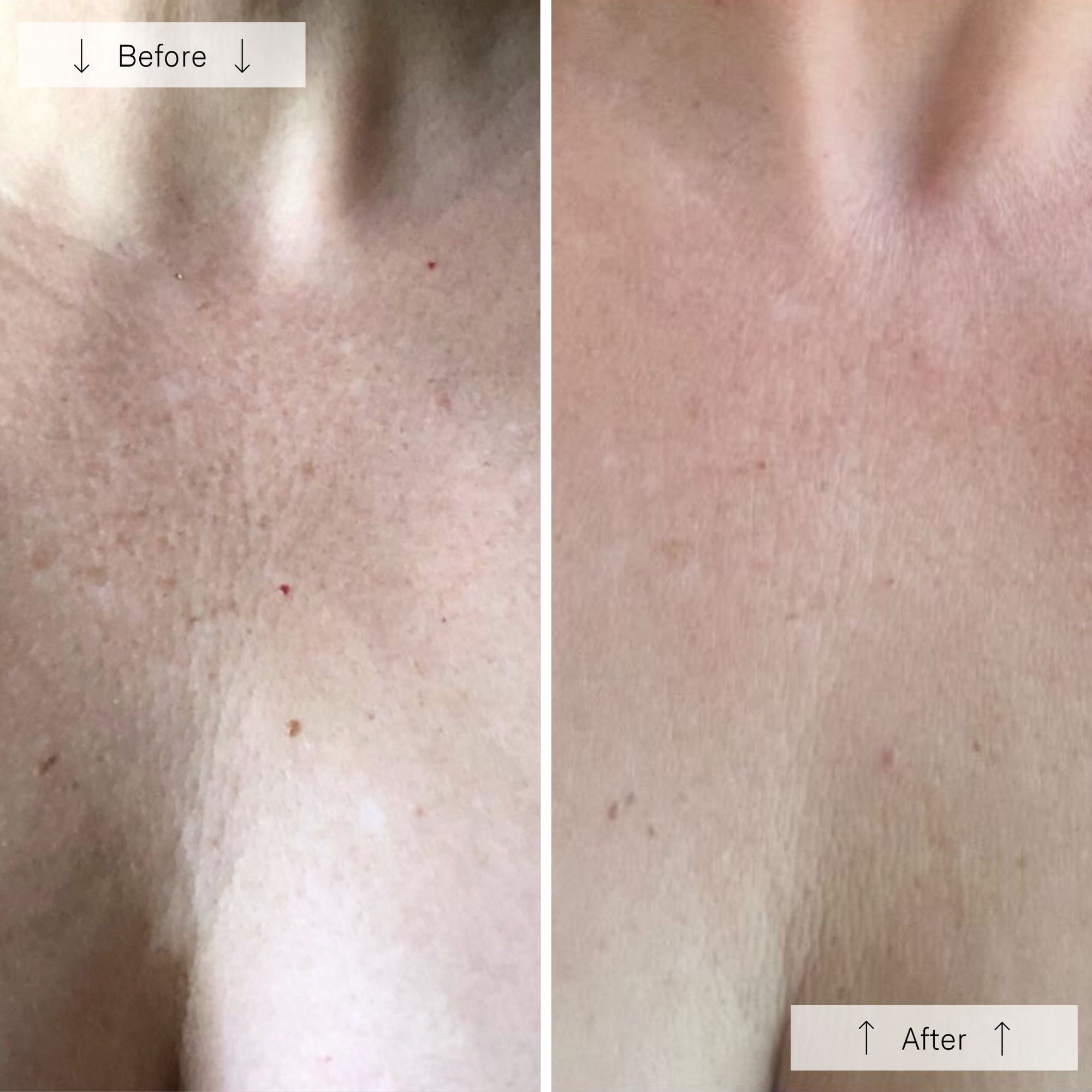 Contour Neck &amp; Décolleté