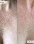 Contour Neck & Décolleté