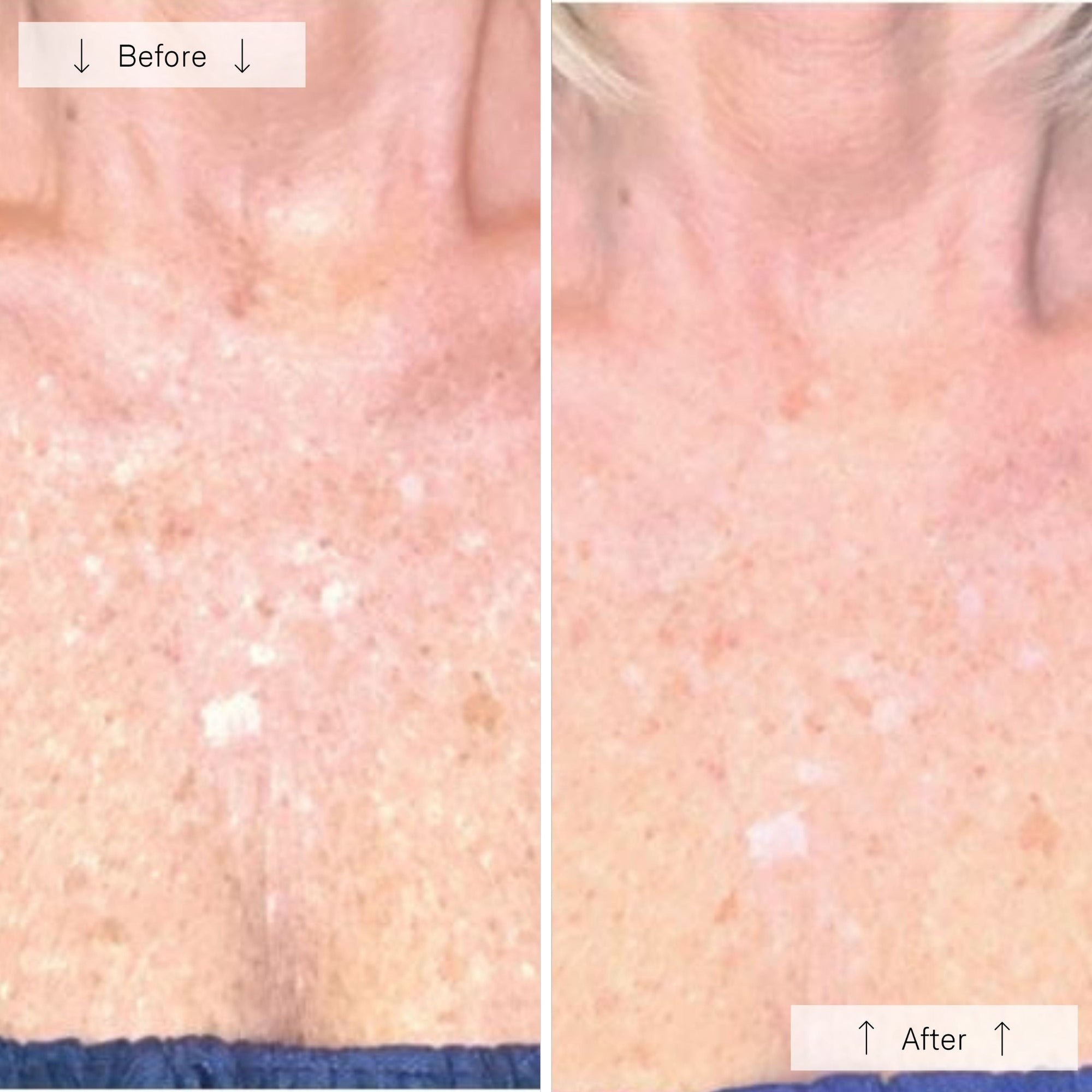 Contour Neck &amp; Décolleté