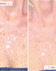 Contour Neck & Décolleté